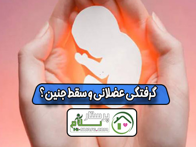 گرفتگی عضلانی و سقط جنین؟