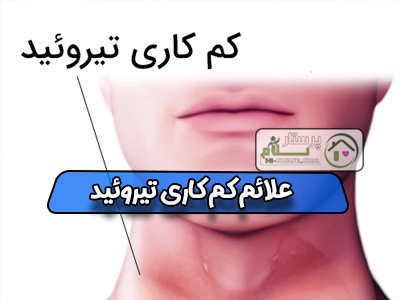 علائم کم کاری تیروئید
